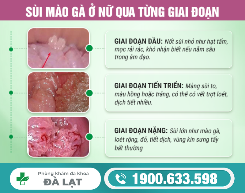 Hình ảnh minh họa